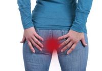 「切れ痔」は女性、「あな痔」は男性がなりやすい〜痔を改善する５つのポイント