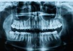 歯型で個人を特定！ 東日本大震災でも使われた「法歯学」の鑑定力