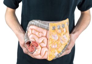 激増する〝大腸がん〟を撃退するコツは?〜乳酸菌を含むヨーグルトや漬物で善玉菌を増やす!