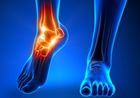 「足」トラブルがあなたの健康寿命を縮める！？ 健康と足の密接な関係とは？
