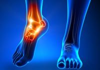 「足」トラブルがあなたの健康寿命を縮める！？ 健康と足の密接な関係とは？