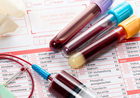 血液検査だけで8種類の「がん」を発見！位置まで特定できる「CancerSEEK」とは？