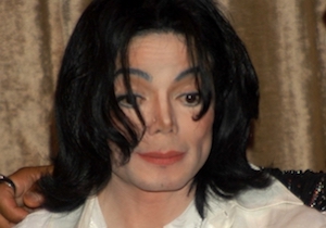 マイケル・ジャクソンも悩まされた皮膚病「白斑（尋常性白斑）」～＜治せる時代＞が到来の画像1