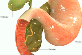 「膵がん」の早期発見につながる血液検査「マルチプレックスプラズモンアッセイ」を開発の画像1