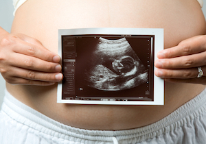 AIとIoTの情報支援コラボレーションで「周産期の妊産婦」を見守る実証実験がスタートの画像1